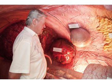 Besucher Prostatamodell